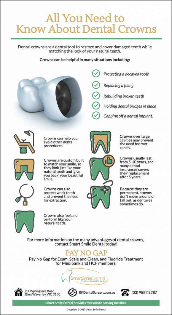 What-You-Need-To-Know-About-Dental-Crowns