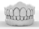 How Long Will Your Dental Crown Last?