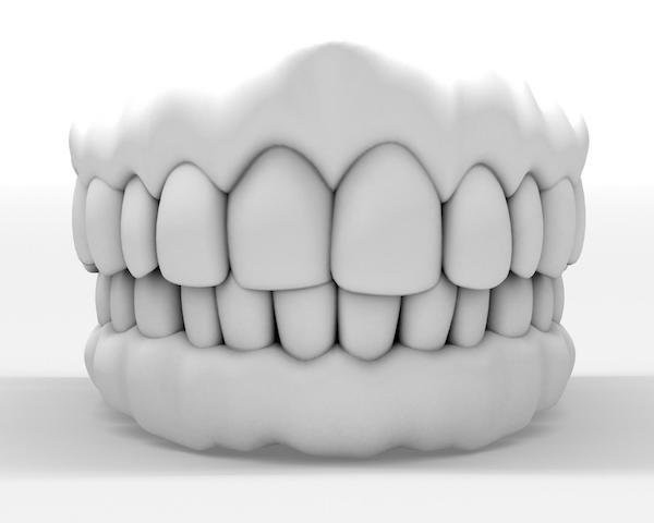 How Long Will Your Dental Crown Last?