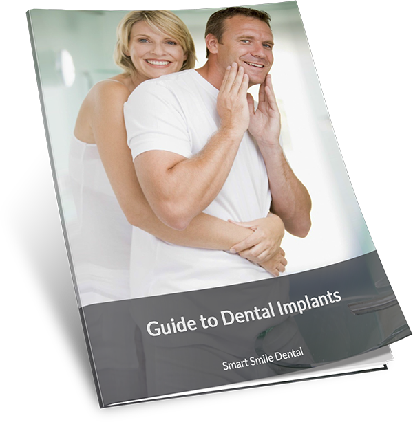 Guide to Dental Implants by SSD